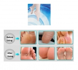 Pflegende Fuß Maske - Peeling und Fußpflege - Hornhautentfernung